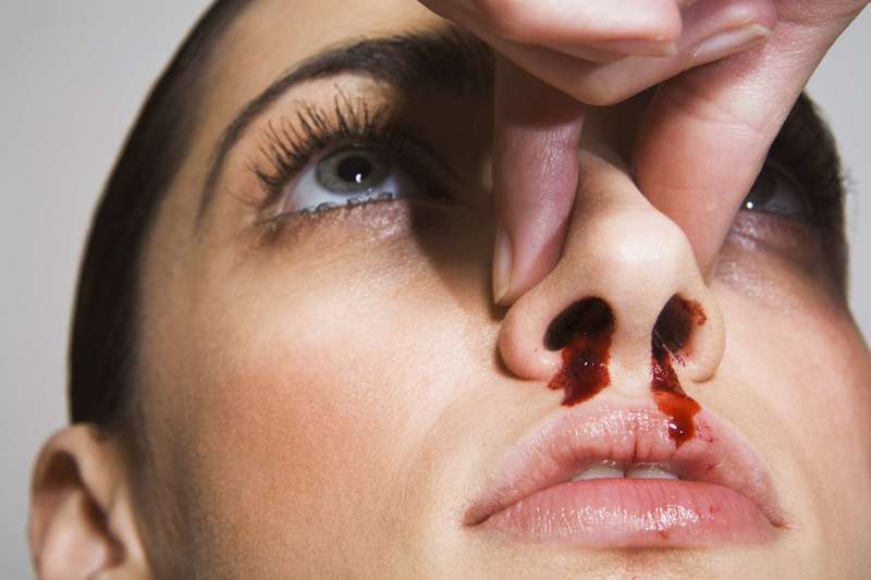 До чого сниться кров з носа: тлумачення сну по популярним сонникам для чоловіків і жінок