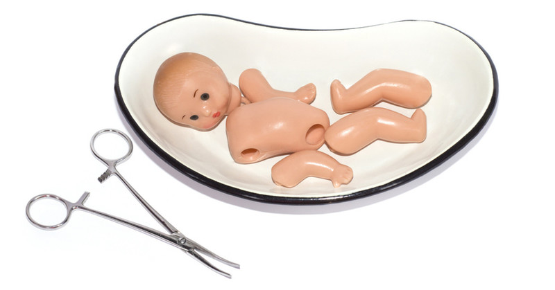 До чого сниться аборт — тлумачення за даними сонника Міллера, Ванги та інших
