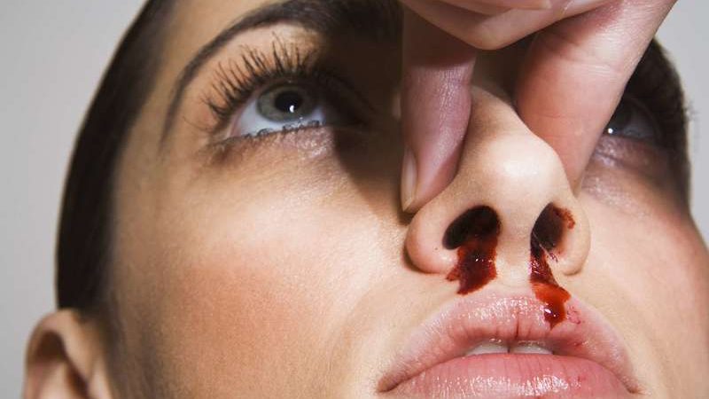 До чого сниться кров з носа: тлумачення сну по популярним сонникам для чоловіків і жінок